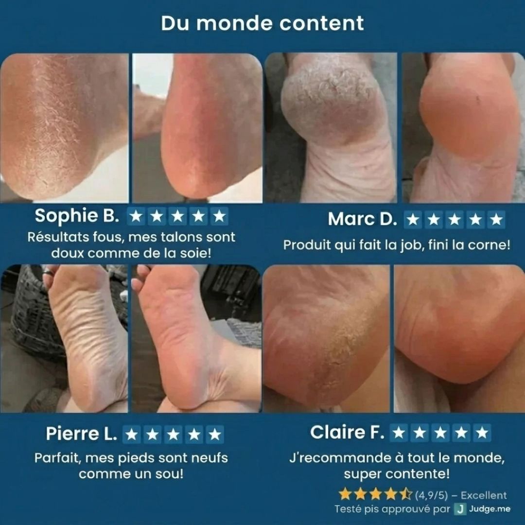 Rape Exfoliante Noddak – Râpe électrique